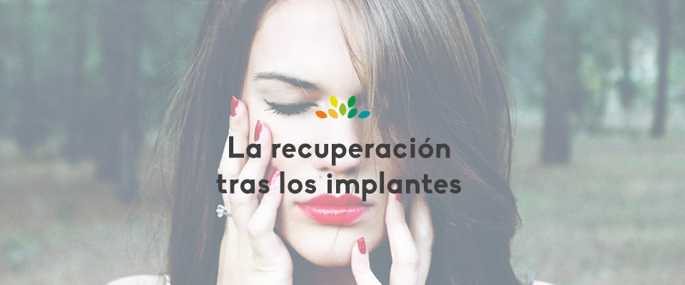 Los implantes dentales y el tiempo de recuperación Dental Asensio