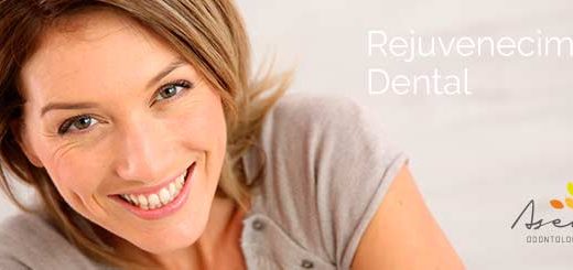 Rejuvenecimiento dental Asensio
