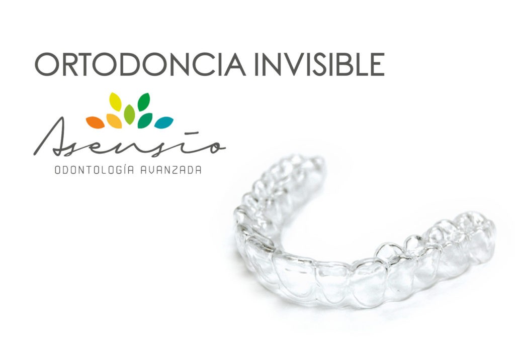 Ortodoncia Invisible - Clínica Dental Asensio